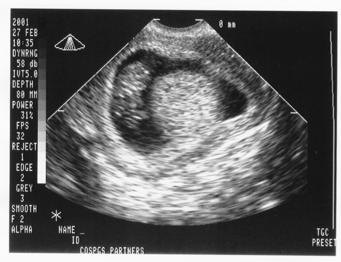 alien ultrasound